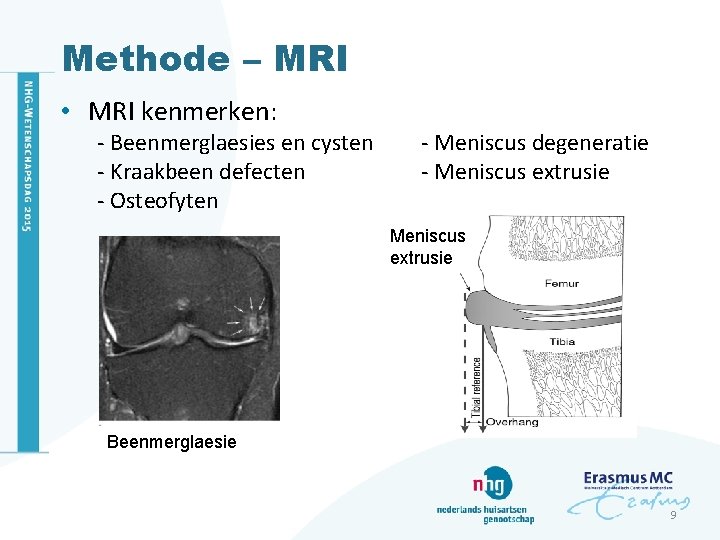 Methode – MRI • MRI kenmerken: - Beenmerglaesies en cysten - Kraakbeen defecten -