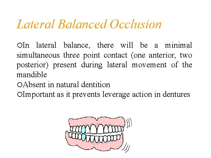 Lateral Balanced Occlusion In lateral balance, there will be a minimal simultaneous three point