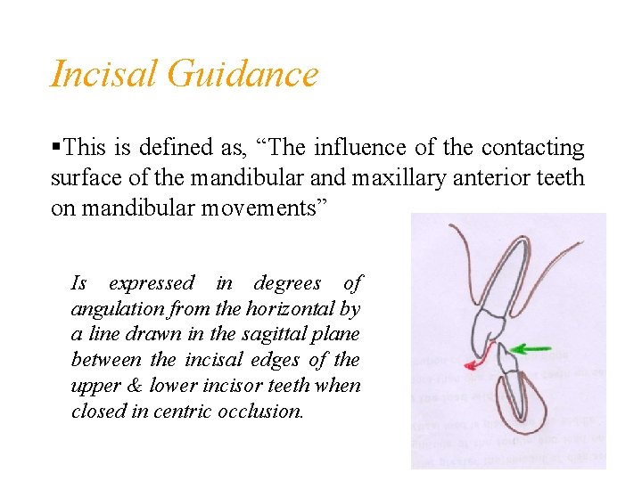 Incisal Guidance This is defined as, “The influence of the contacting surface of the