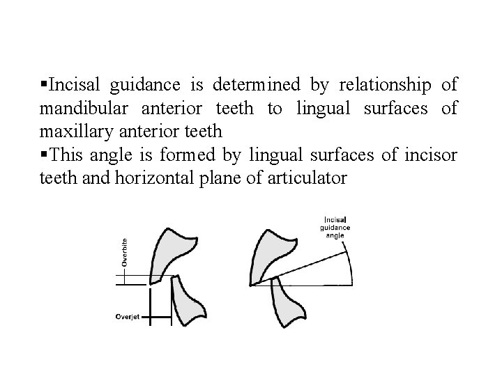  Incisal guidance is determined by relationship of mandibular anterior teeth to lingual surfaces