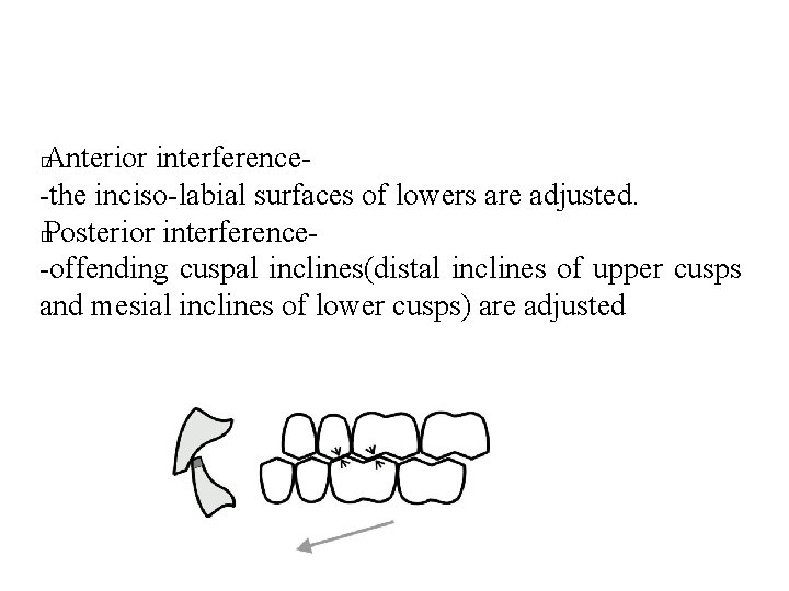 Anterior interference-the inciso-labial surfaces of lowers are adjusted. � Posterior interference-offending cuspal inclines(distal inclines