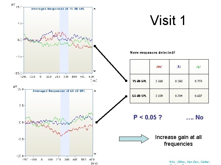 Visit 1 P < 0. 05 ? …. No Increase gain at all frequencies