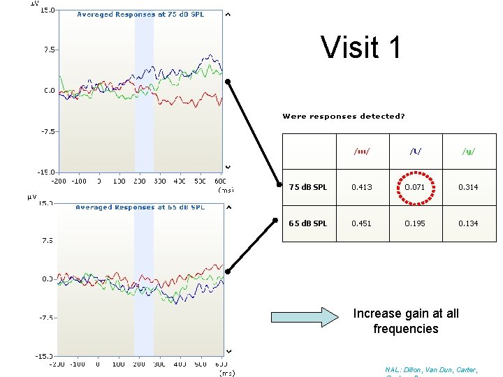 Visit 1 Increase gain at all frequencies NAL: Dillon, Van Dun, Carter, 