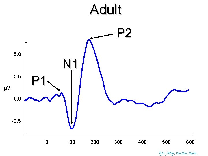 Adult P 2 5. 0 2. 5 µV N 1 P 1 0. 0