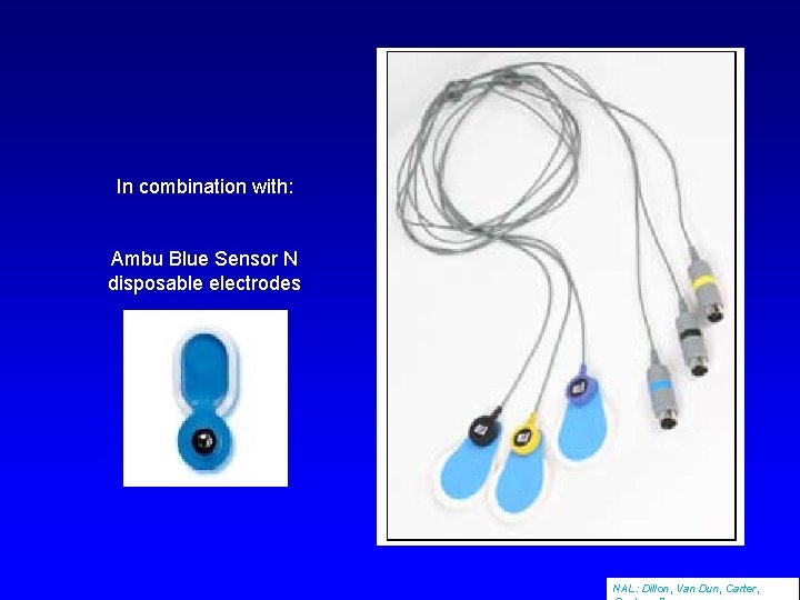 In combination with: Ambu Blue Sensor N disposable electrodes NAL: Dillon, Van Dun, Carter,