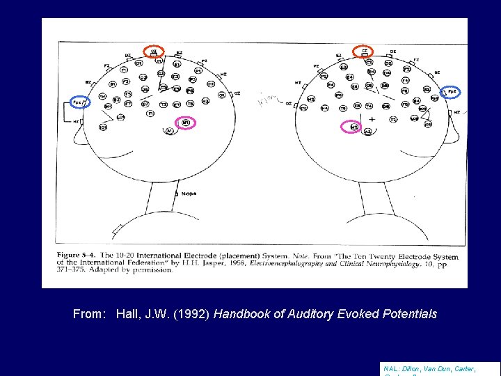 From: Hall, J. W. (1992) Handbook of Auditory Evoked Potentials NAL: Dillon, Van Dun,