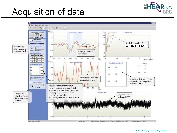 Acquisition of data detection of response NAL: Dillon, Van Dun, Carter, 