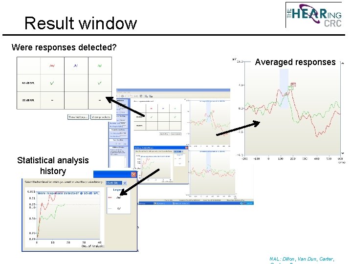 Result window Were responses detected? Averaged responses Statistical analysis history NAL: Dillon, Van Dun,