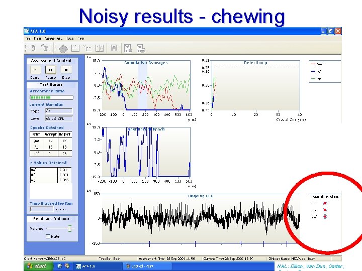 Noisy results - chewing NAL: Dillon, Van Dun, Carter, 