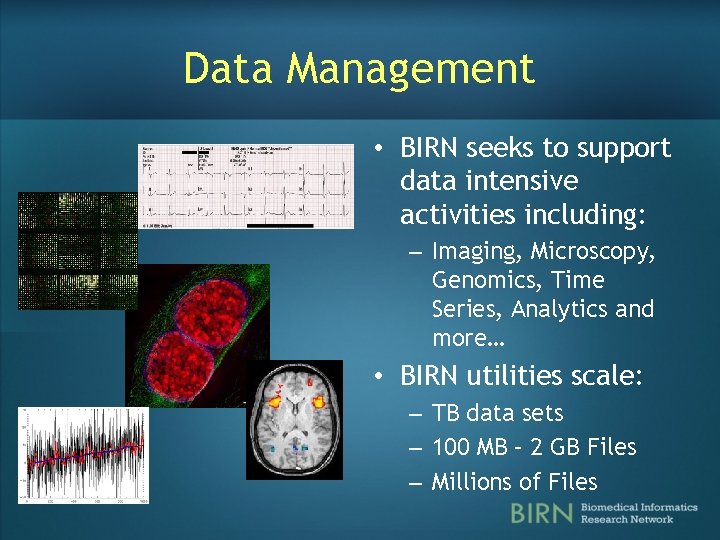 Data Management • BIRN seeks to support data intensive activities including: – Imaging, Microscopy, Data Management • BIRN seeks to support data intensive activities including: – Imaging, Microscopy,