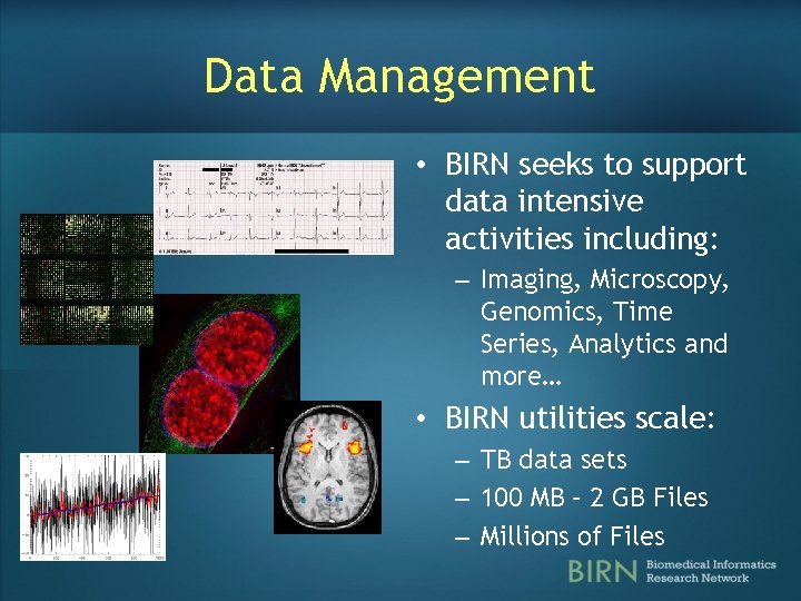 Data Management • BIRN seeks to support data intensive activities including: – Imaging, Microscopy,