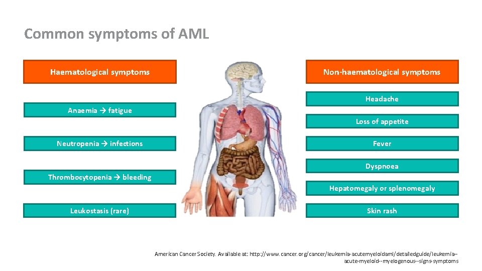 Common symptoms of AML Haematological symptoms Non-haematological symptoms Headache Anaemia → fatigue Loss of