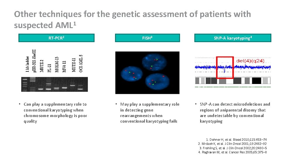 Other techniques for the genetic assessment of patients with suspected AML 1 RT-PCR 2
