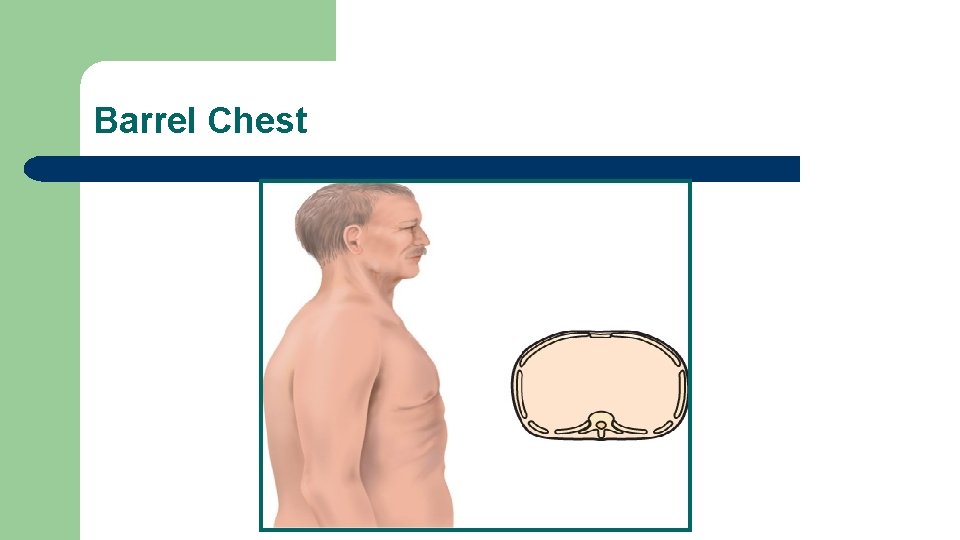 Barrel Chest Barrel Chest