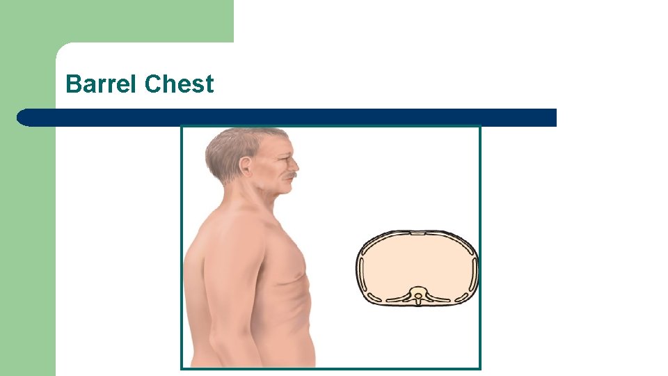 Barrel Chest 