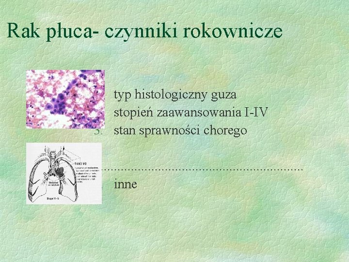 Rak płuca- czynniki rokownicze 1. typ histologiczny guza 2. stopień zaawansowania I-IV 3. stan