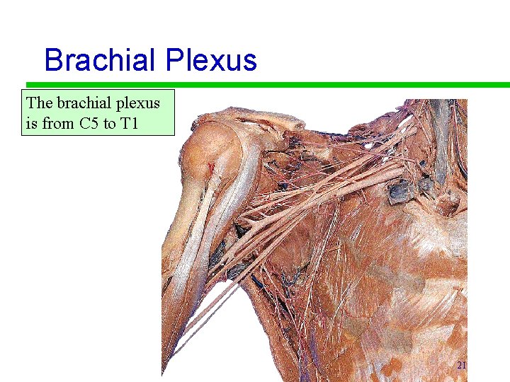Brachial Plexus The brachial plexus is from C 5 to T 1 21 