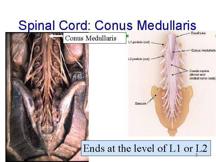 Spinal Cord: Conus Medullaris Ends at the level of L 1 or L 2