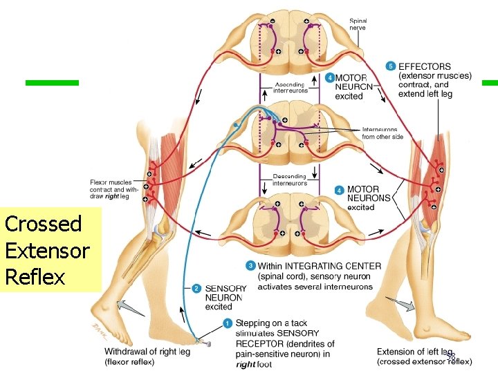 Crossed Extensor Reflex 58 