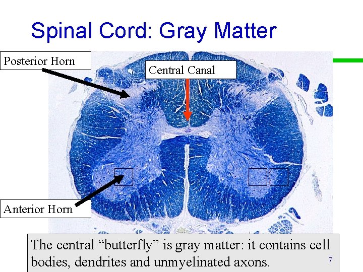 Spinal Cord: Gray Matter Posterior Horn Central Canal Anterior Horn The central “butterfly” is