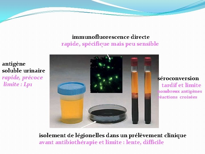 immunofluorescence directe rapide, spécifique mais peu sensible antigène soluble urinaire rapide, précoce limite :