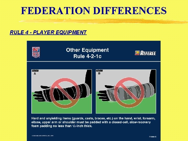 FEDERATION DIFFERENCES RULE 4 - PLAYER EQUIPMENT 