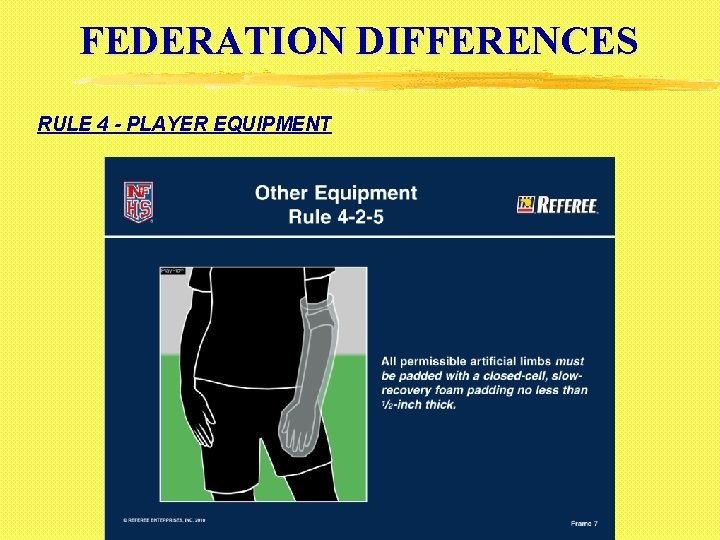 FEDERATION DIFFERENCES RULE 4 - PLAYER EQUIPMENT 