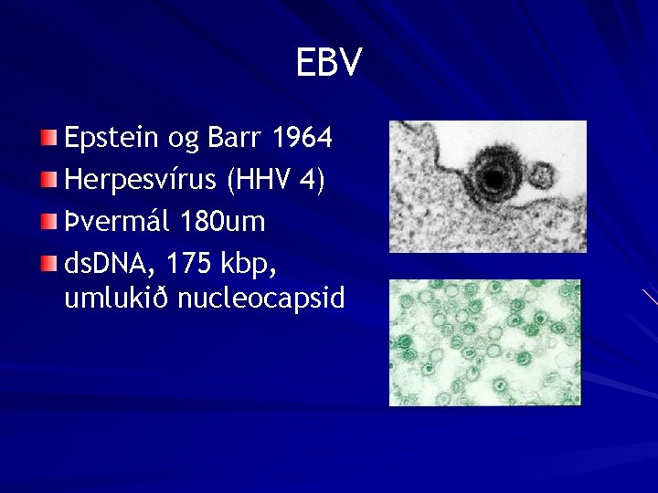 EBV Epstein og Barr 1964 Herpesvírus (HHV 4) Þvermál 180 um ds. DNA, 175