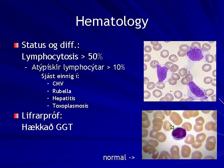Hematology Status og diff. : Lymphocytosis > 50% – Atýpískir lymphocýtar > 10% Sjást
