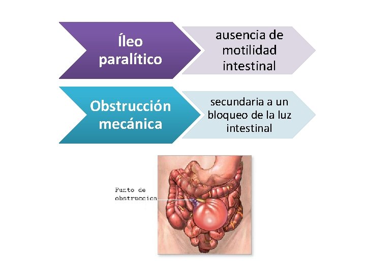 Íleo paralítico ausencia de motilidad intestinal Obstrucción mecánica secundaria a un bloqueo de la