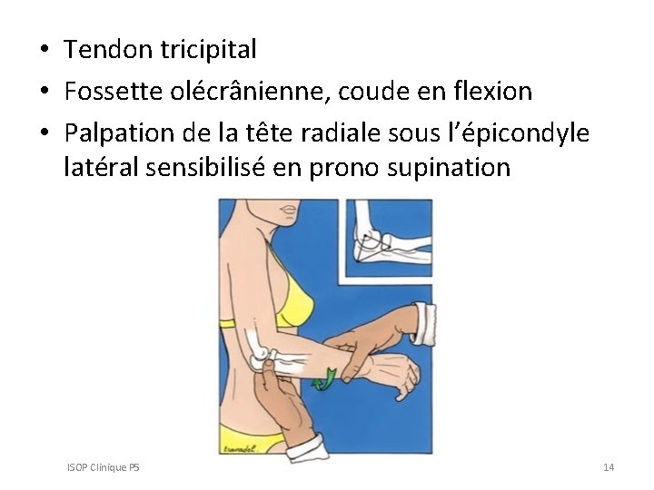  • Tendon tricipital • Fossette olécrânienne, coude en flexion • Palpation de la