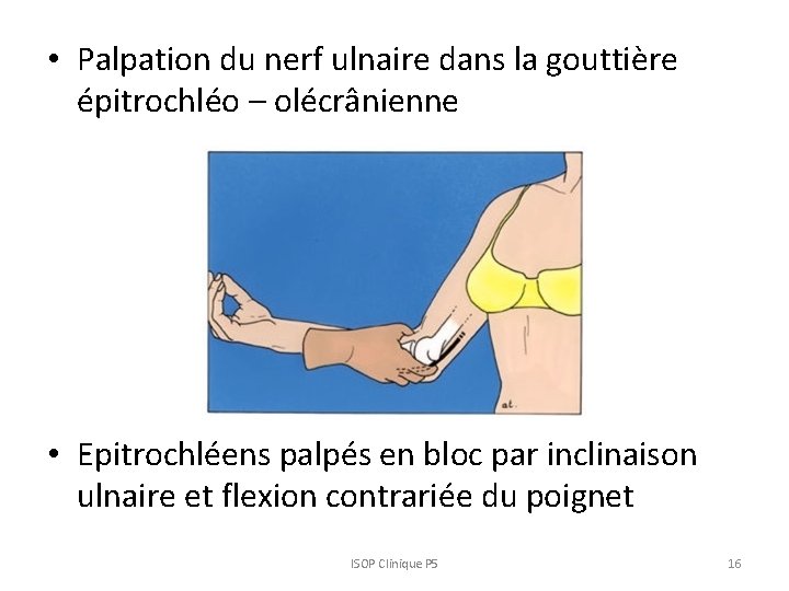  • Palpation du nerf ulnaire dans la gouttière épitrochléo – olécrânienne • Epitrochléens