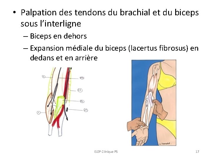  • Palpation des tendons du brachial et du biceps sous l’interligne – Biceps