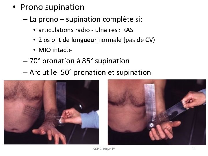  • Prono supination – La prono – supination complète si: • articulations radio