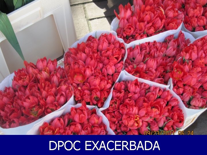 DPOC EXACERBADA 