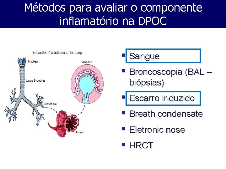 Métodos para avaliar o componente inflamatório na DPOC § Sangue § Broncoscopia (BAL –