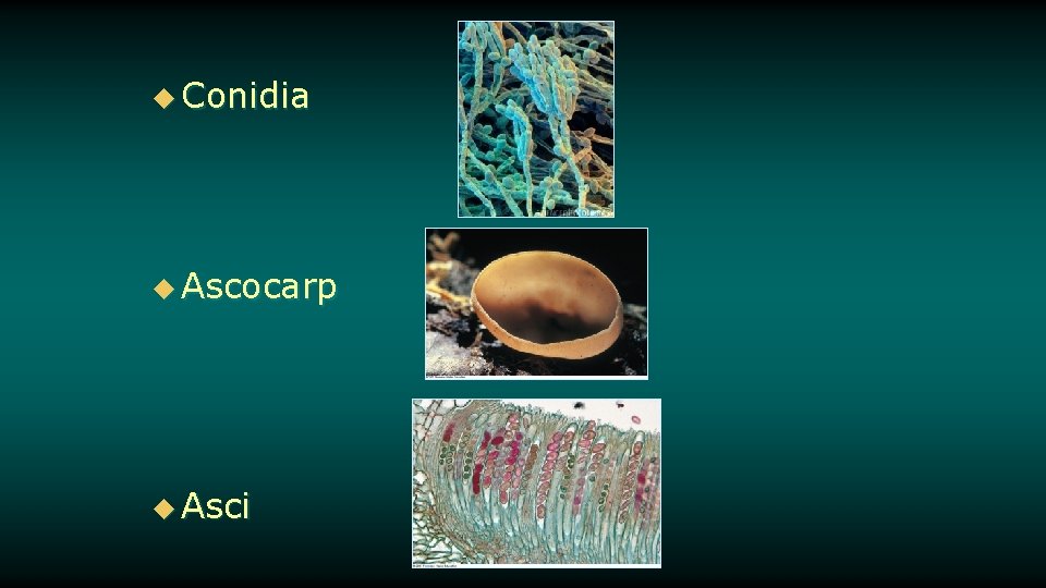 u Conidia u Ascocarp u Asci 