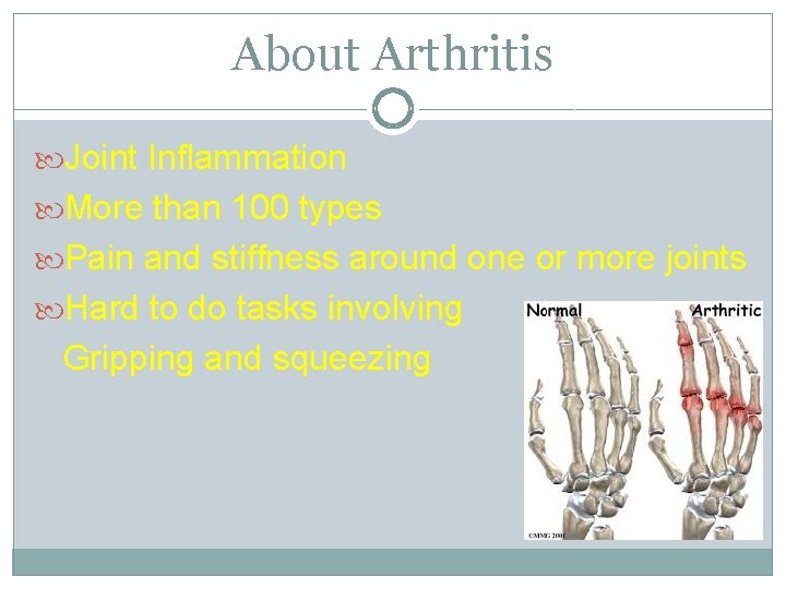 About Arthritis Joint Inflammation More than 100 types Pain and stiffness around one or