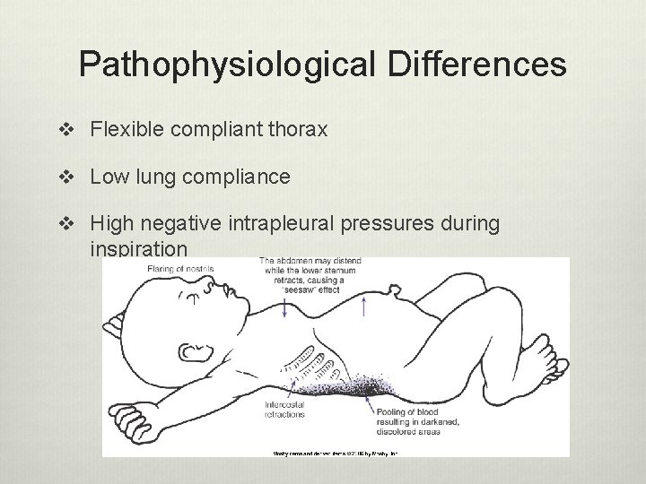 Pathophysiological Differences v Flexible compliant thorax v Low lung compliance v High negative intrapleural