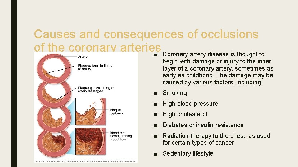 Causes and consequences of occlusions of the coronary arteries ■ Coronary artery disease is