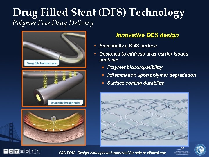 Drug Filled Stent (DFS) Technology Polymer Free Drug Delivery Innovative DES design • Essentially