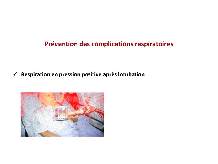 Prévention des complications respiratoires ü Respiration en pression positive après Intubation 