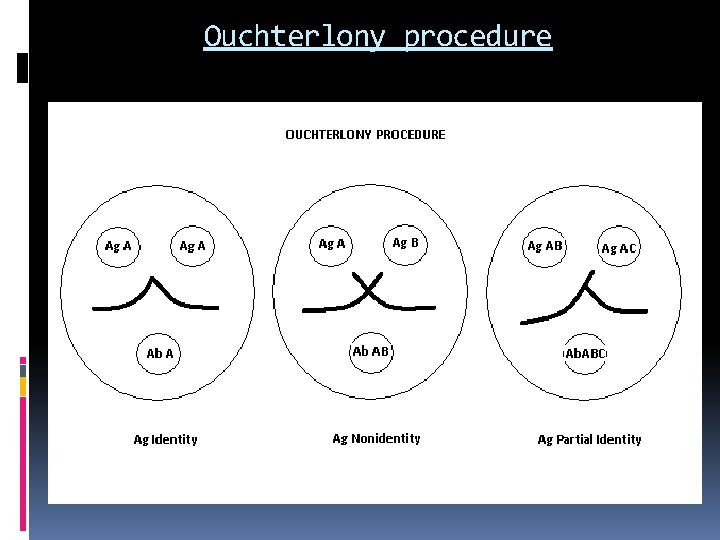 Ouchterlony procedure 