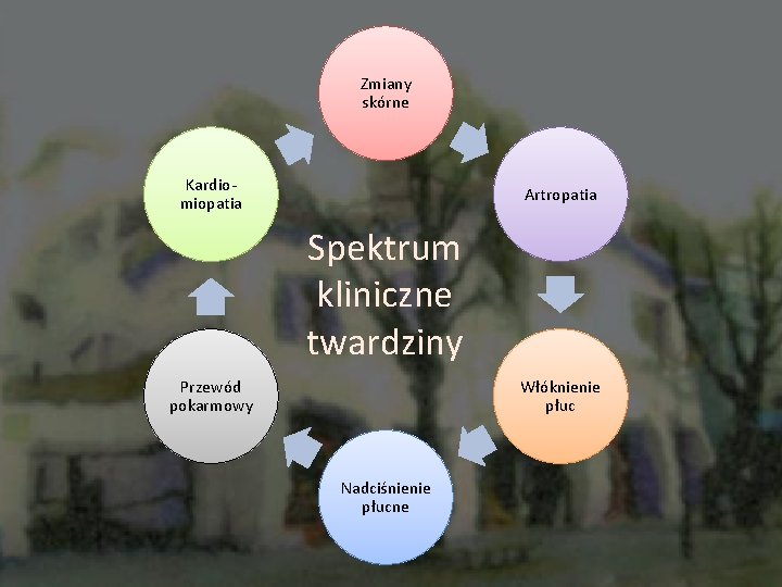 Zmiany skórne Kardiomiopatia Artropatia Spektrum kliniczne twardziny Przewód pokarmowy Włóknienie płuc Nadciśnienie płucne 