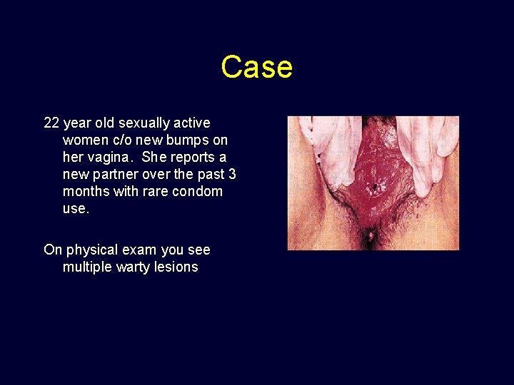 Case 22 year old sexually active women c/o new bumps on her vagina. She