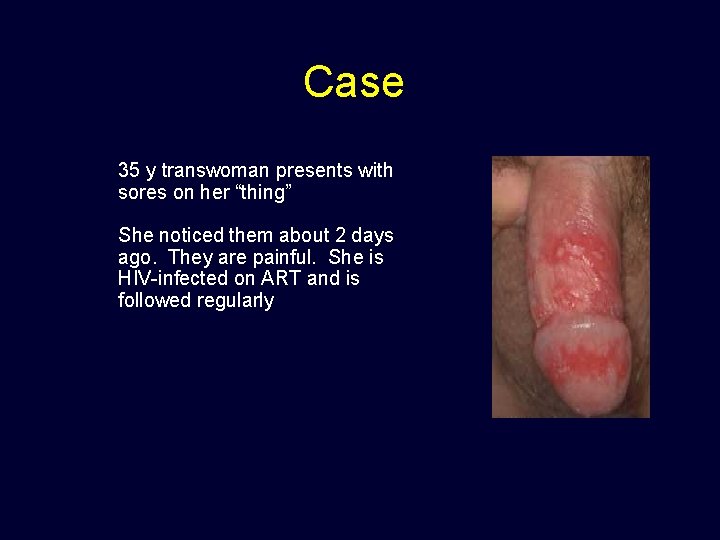 Case • 35 y transwoman presents with sores on her “thing” • She noticed