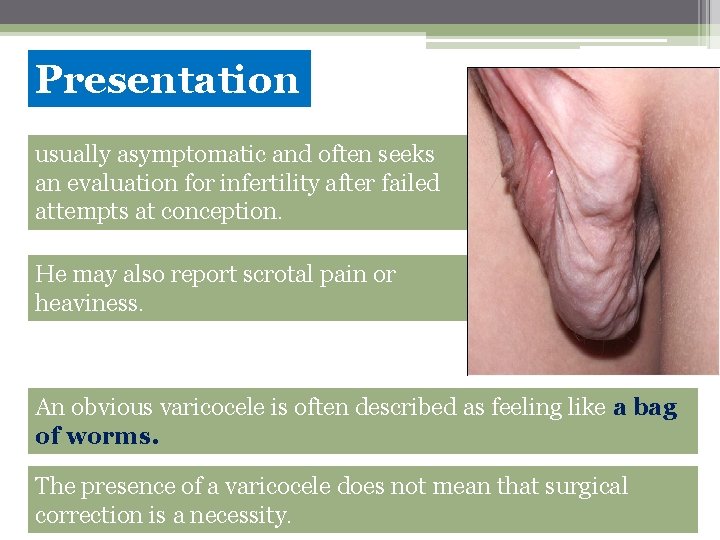 Presentation usually asymptomatic and often seeks an evaluation for infertility after failed attempts at
