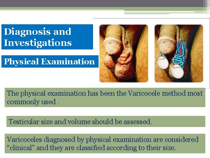Diagnosis and Investigations Physical Examination The physical examination has been the Varicocele method most