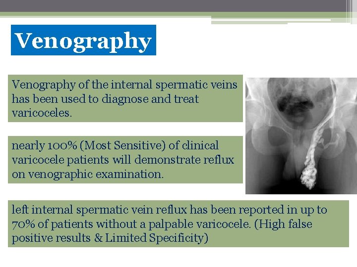Venography of the internal spermatic veins has been used to diagnose and treat varicoceles.