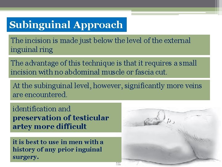 Subinguinal Approach The incision is made just below the level of the external inguinal